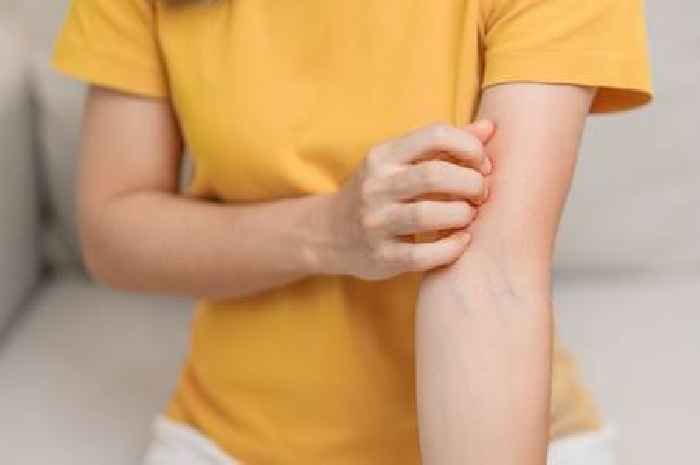 Red flag symptoms of condition affecting 69,000 women as hopes grow of cure