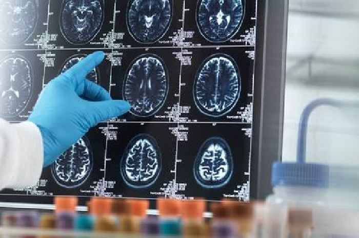 New dementia symptoms warning as doctors told to watch out for these health problems