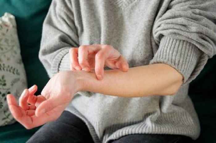 People with dry skin or eczema urged to follow seven steps this winter