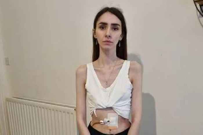 Scots student loses half her body weight in six months after stomach paralysis 'hell'