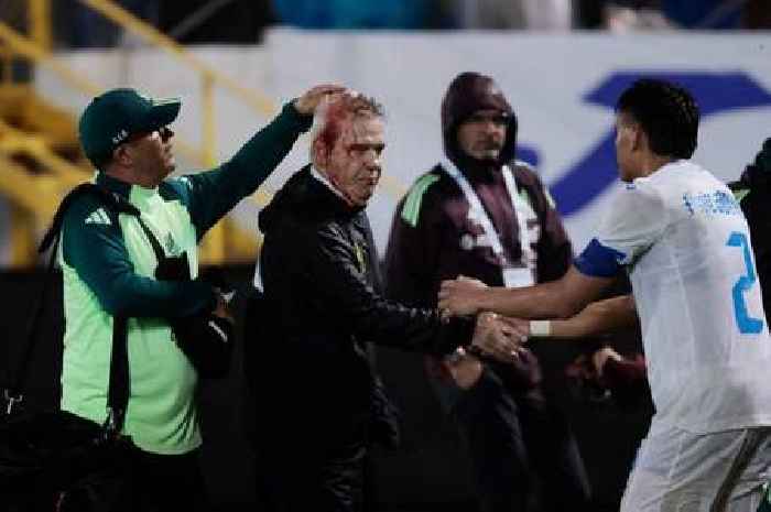 Luis Palma goes clutch for Honduras before Celtic star sees things turn nasty with Mexico manager left covered in BLOOD