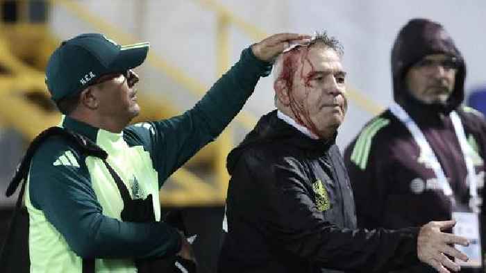 Mexico Coach Aguirre hit on head by Beer Can