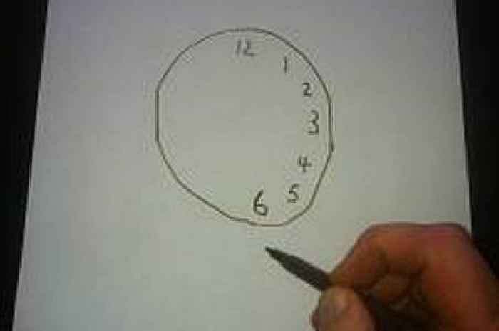 Simple dementia clock-drawing test you can do at home to spot condition early