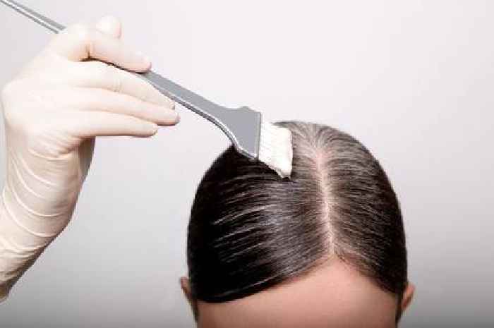 Doctor shares little-known reason for early grey hairs – and how to slow down process