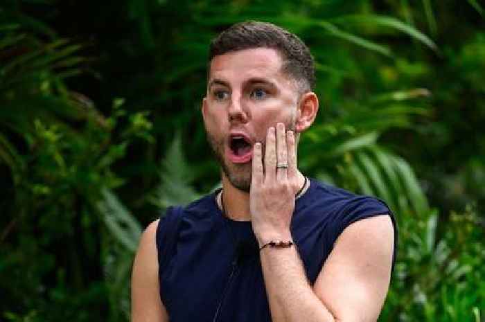 I’m A Celeb star Dean McCullough's four-figure hair transplant before jungle adventure