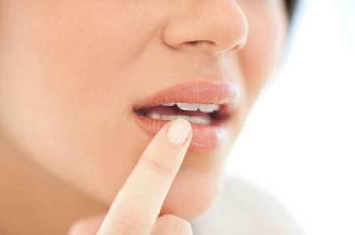 Doctor says recurring cold sore or mouth ulcer can be warning sign of something else