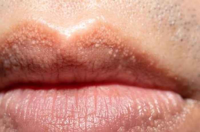 If your lips look like this you may need to talk to a doctor