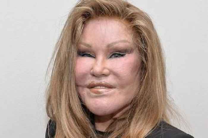 'Catwoman' Jocelyn Wildenstein, famed for extreme plastic surgery, dies at 84