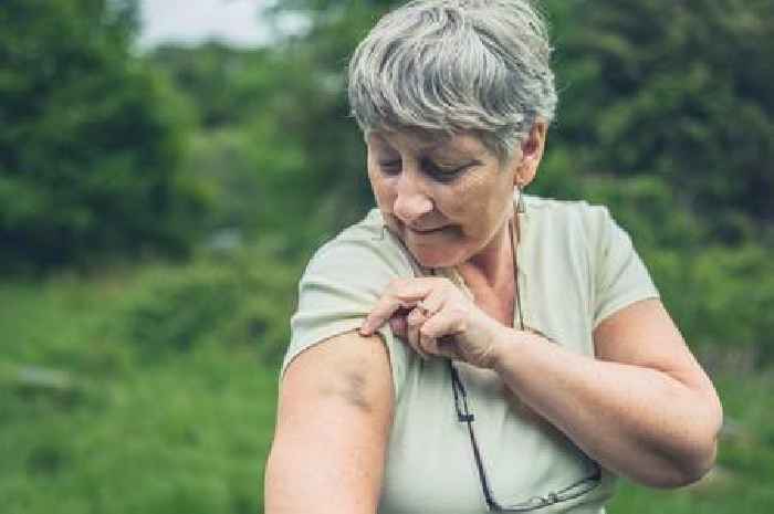 The One Show doctor shares little-known sign of cancer on skin to watch out for