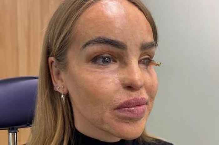 Loose Women's Katie Piper shares brave eye surgery 'battle' update in new video