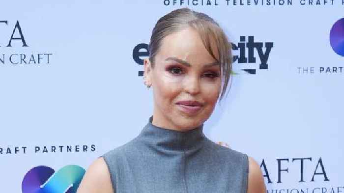 Katie Piper reveals artificial eye decision - 16 years after acid attack