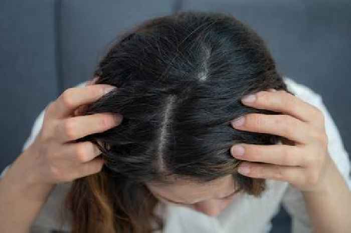 Nutritionist highlights surprising nut that could prevent hair loss and baldness