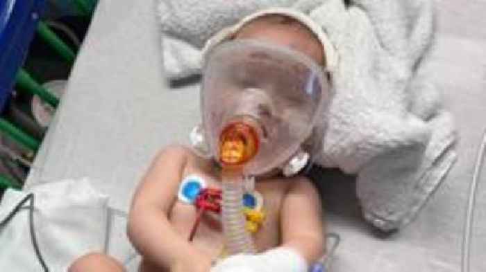 Ill baby's mum urges pregnant women to get RSV jab