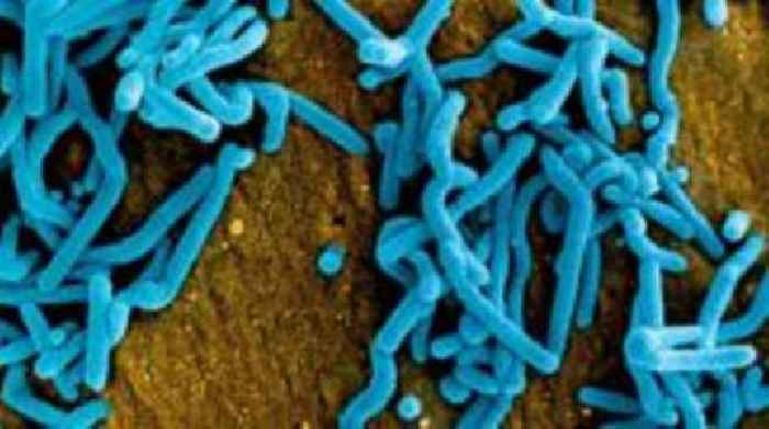 New suspected Marburg outbreak in Tanzania kills eight - WHO