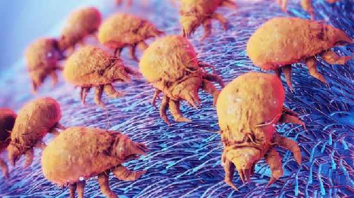 'Life-changing' treatment could help thousands of people with severe dust mite allergy