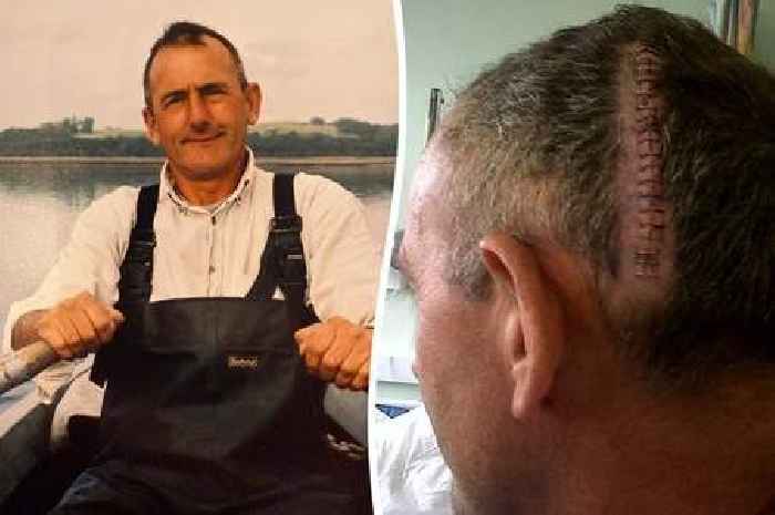 Dad's brain tumour symptoms were 'dismissed as stress' before devastating diagnosis