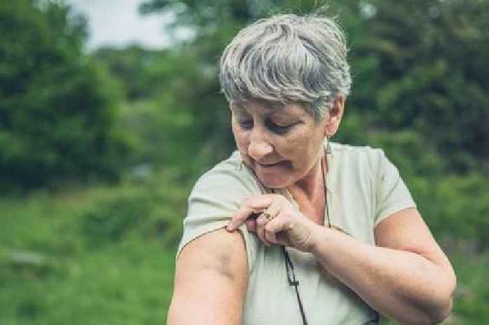 Doctor shares blood cancer symptom you should 'never ignore' – it shows on skin