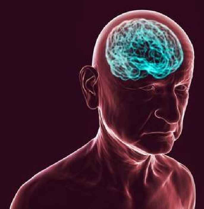 Dementia expert shares one thing you can do to prevent the disease