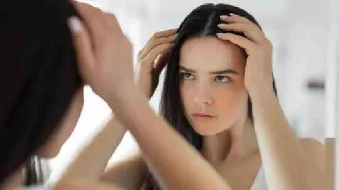 Expert report blames high selenium in wheat over Buldana hair loss cases