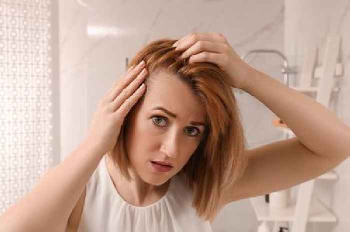 'I'm a hair surgeon - eat these 10 foods to prevent hair loss'