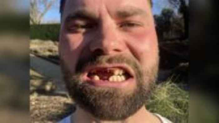 Man loses nine teeth in suspected catapult attack