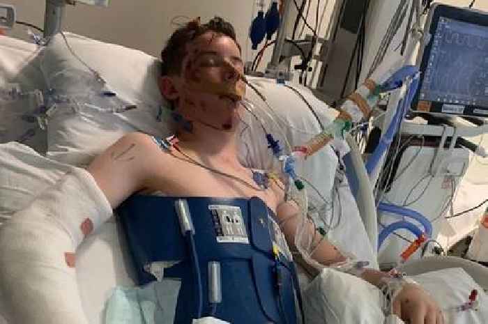 Essex man spent 11 months in hospital after being hit by 'speeding motorcyclist'