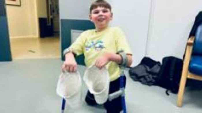 Double-amputee boy will soon not need crutches to walk