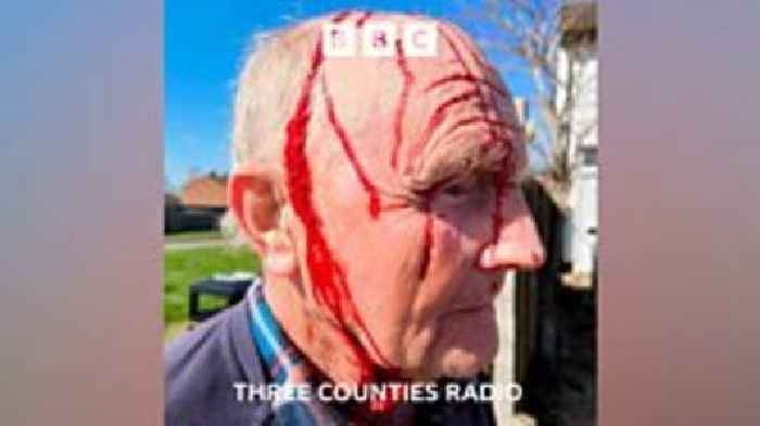 Herts hawk attacks: ‘People are scared to go out’