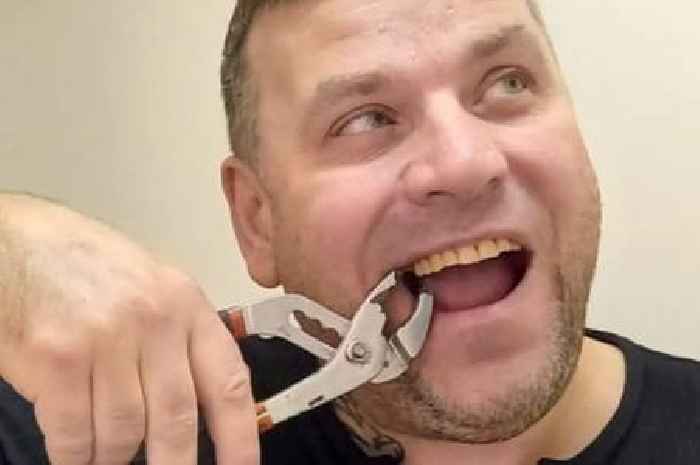 Dad pulled out tooth with wrench because he couldn't get appointment