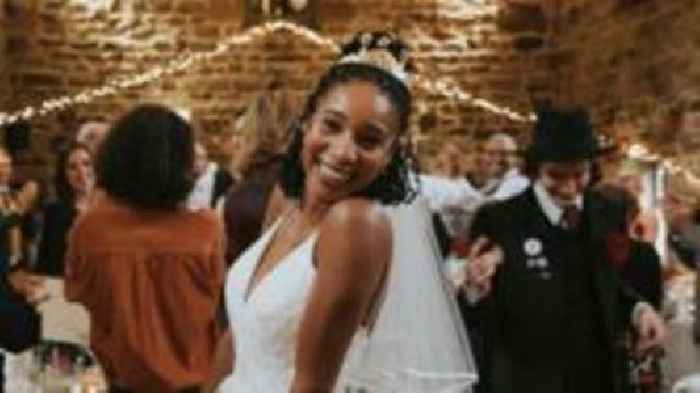 Cancer taught Casualty actor to say yes to life