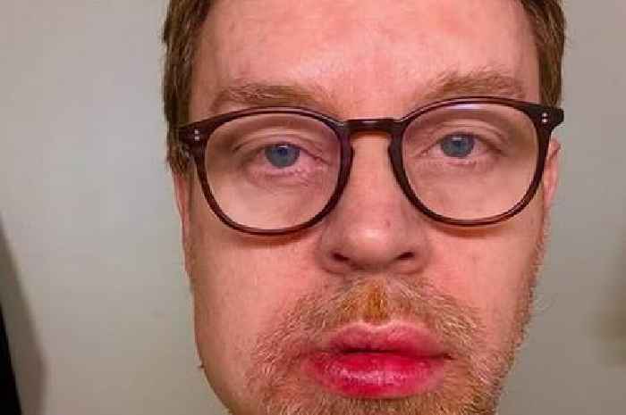 90s pop star shares shocking photos of injuries as he says 'so grateful to be alive'