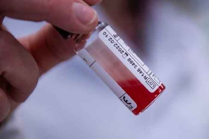 New blood test could detect 12 cancers before symptoms appear
