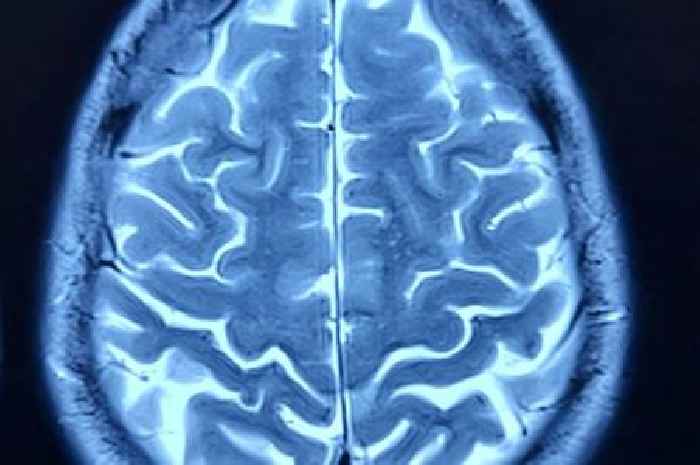 Individuals with one health issue may suffer 'earlier decline' in cognitive function