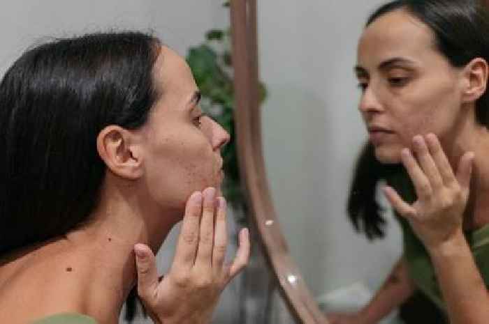 Dermatologist shares big 'mistake' everyone with acne breakouts makes