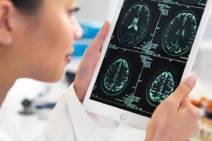 Neurologist shares four ways to 'reverse dementia-like symptoms'