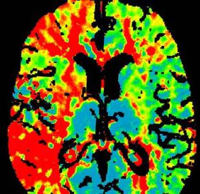 Cutting out one beverage may lower Alzheimer's and dementia threat say studies