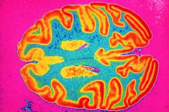 Dementia risk may be reduced by drinking less of one beverage - it's not coffee