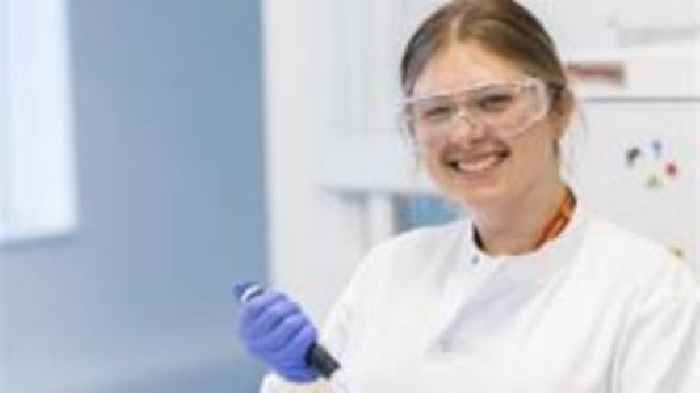 Jersey student leads fatty liver disease project