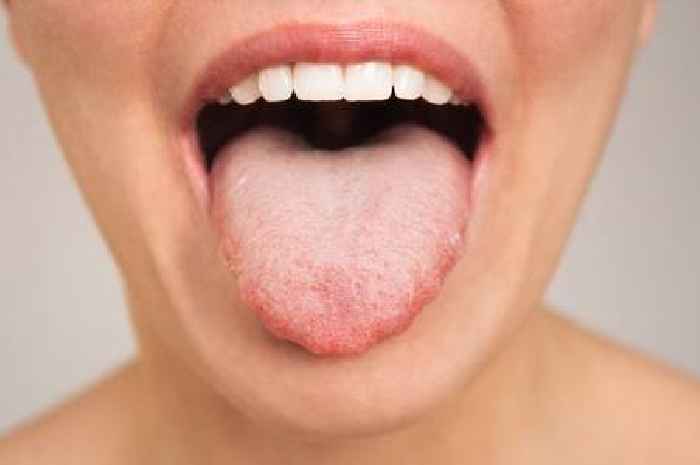 Dentist warns 'it can be a surprise' as weight loss drug leads to unexpected side effect