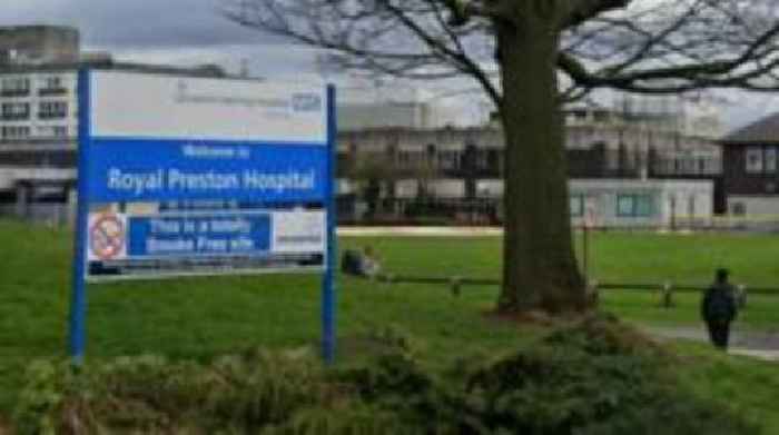 Free staff bus between hospitals axed over costs