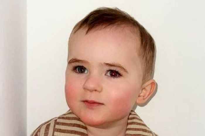Unusual white glow in toddler's eye leads to rare cancer diagnosis