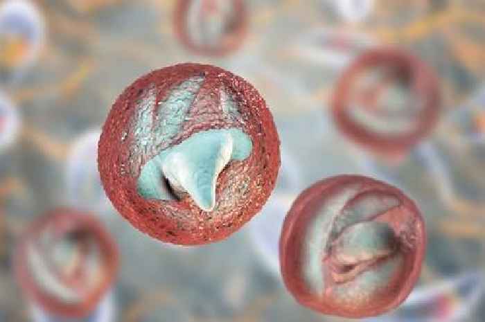 Cryptosporidium parasite explained as 4-year-old boy among 74 infected in UK