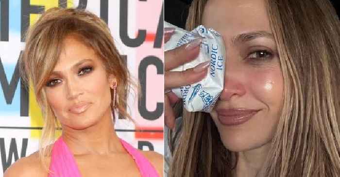 Jennifer Lopez Gets Stitches After Suffering Injury During American Music Awards Rehearsals: See Photos