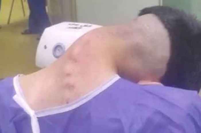 Man's head flops to one side after battling one addiction for years
