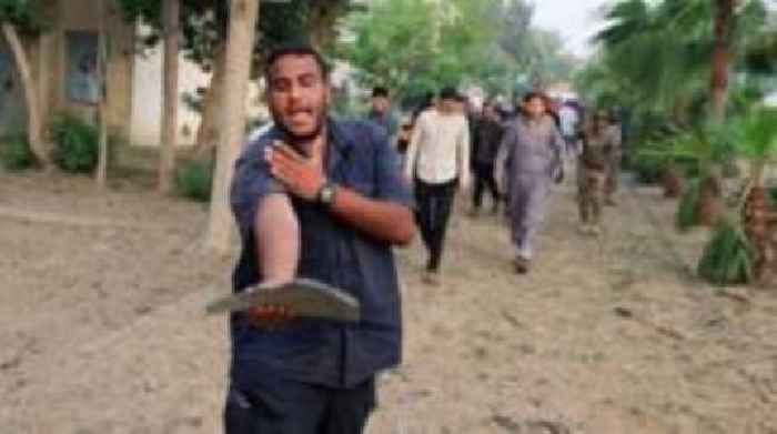 BBC cameraman haunted by Gaza's malnourished children captures Israeli strike on hospital
