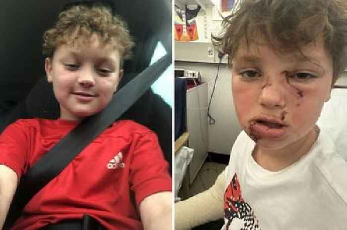 Eight-year-old Goole boy ‘recovering well’ after surgery following dog attack