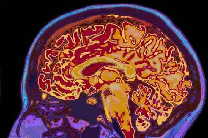 Making two key lifestyle switches may 'slash dementia risk' and cognitive decline