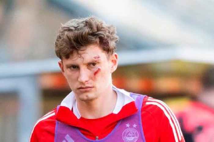 Grotesque Jack MacKenzie incident sparks fury aimed at Aberdeen yob as Jim Goodwin lets rip over vile attack