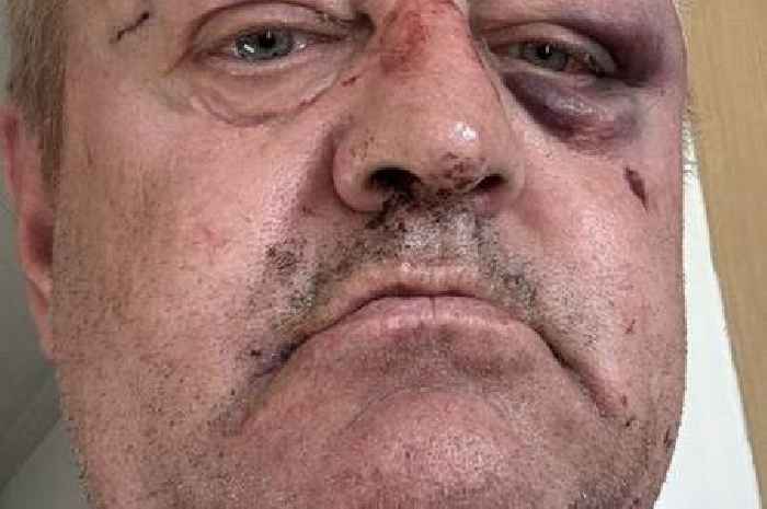 Man badly injuried after being attacked in his own home