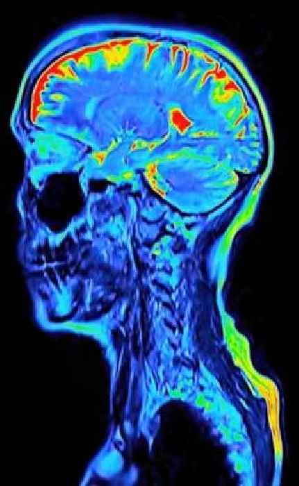 Every symptom of dementia as half of people don't know signs